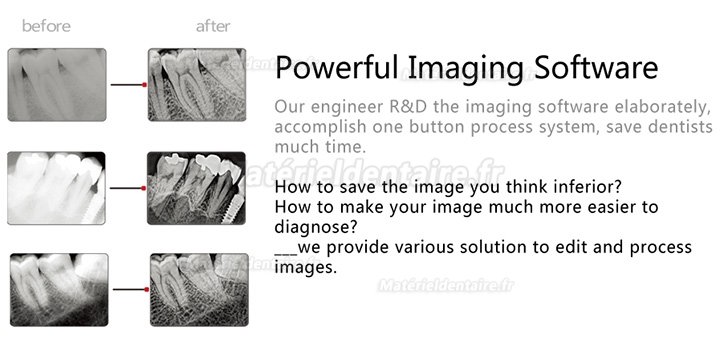 Handy HDR-600 Capteur intra-oral pour radiographie dentaire système d'imagerie numérique